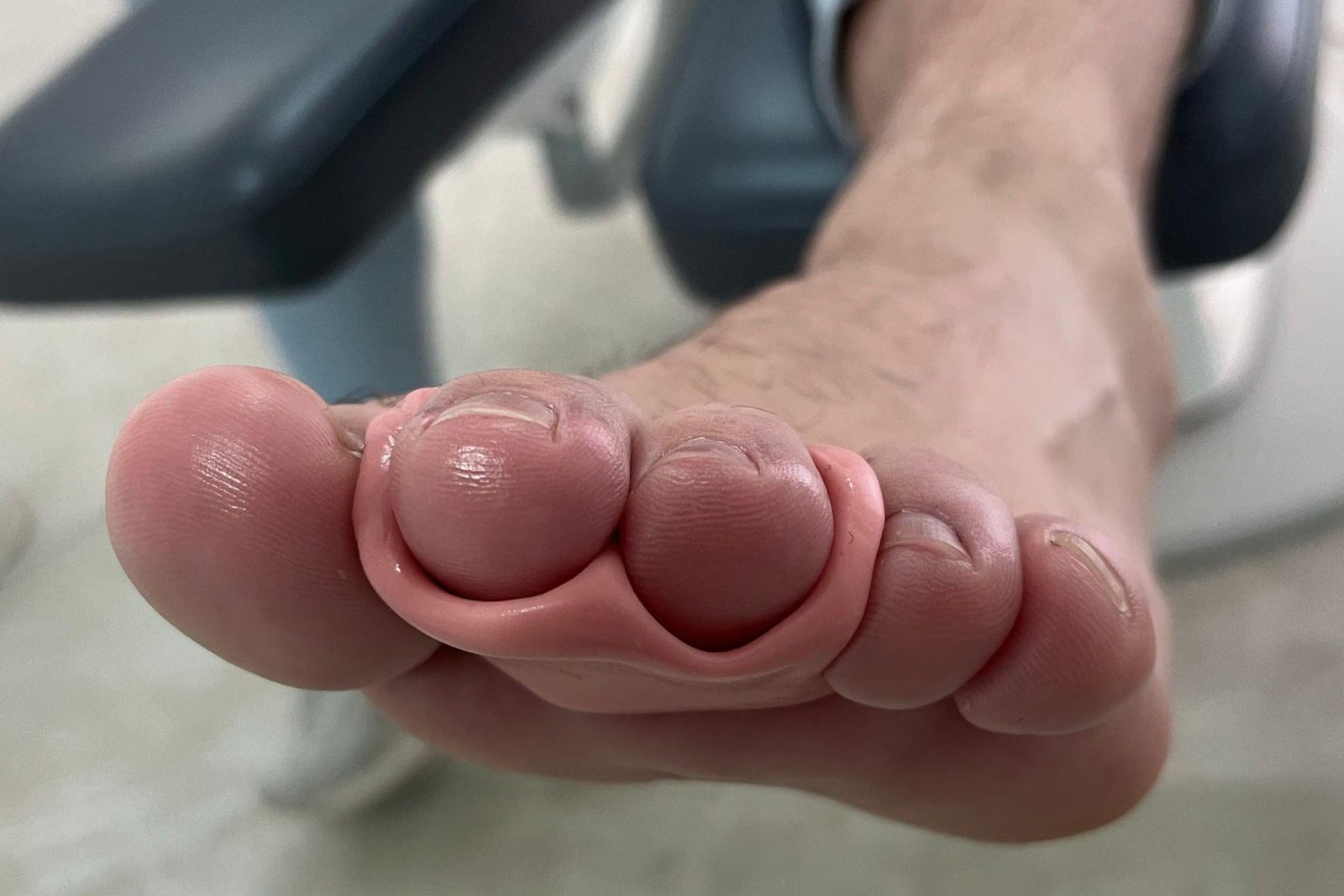 SILICONASAMEDIDA1739364951